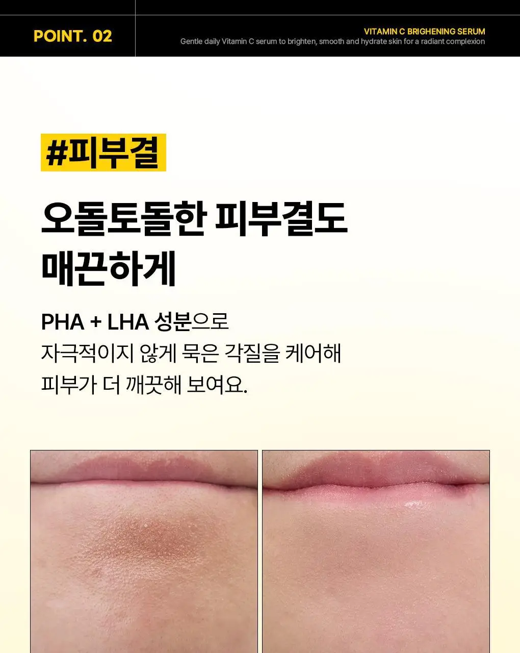 [장도연 PICK/1+1] 메디힐 비타민씨 브라이트닝 세럼 40+40ml 더블 기획 상세페이지 8